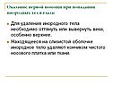 Оказание первой помощи