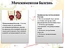 Мочекаменная болезнь