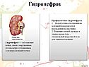 Гидронефроз