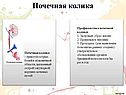 Почечная колика