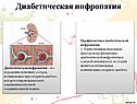 Диабетическая нифропатия