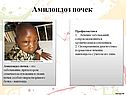 Амилоидоз почек