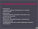 Основные типы загрязнения