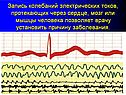 Запись колебаний электрических токов, протекающих через сердце, мозг
