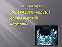 Инфразвук и ультразвук