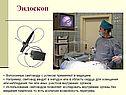 Эндоскоп