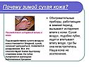 Почему зимой сухая кожа
