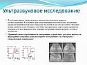 Ультразвуковое исследование