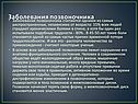 Заболевания позвоночника