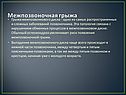 Межпозвоночная грыжа