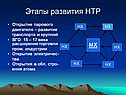 Этапы развития НТР
