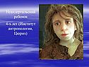 Неандертальский ребенок 4-х лет (Институт антропологии, Цюрих)