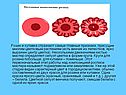 Розан и купавка отражают самые главные признаки, присущие многим