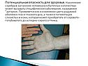 Потенциальная опасность для здоровья